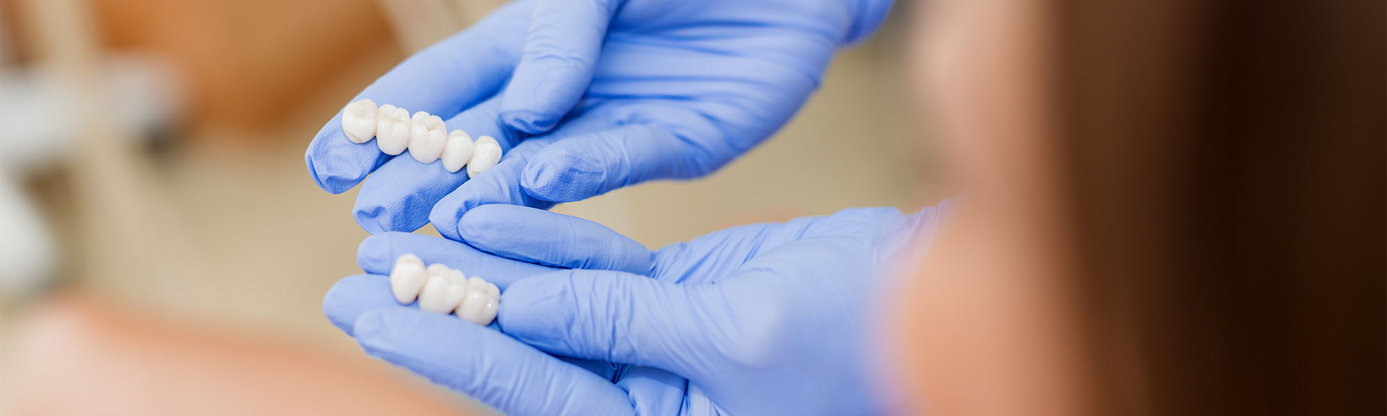 Dental Crowns Cerritos CA