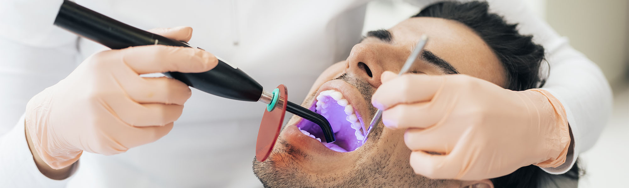 Dental Sealants Cerritos CA