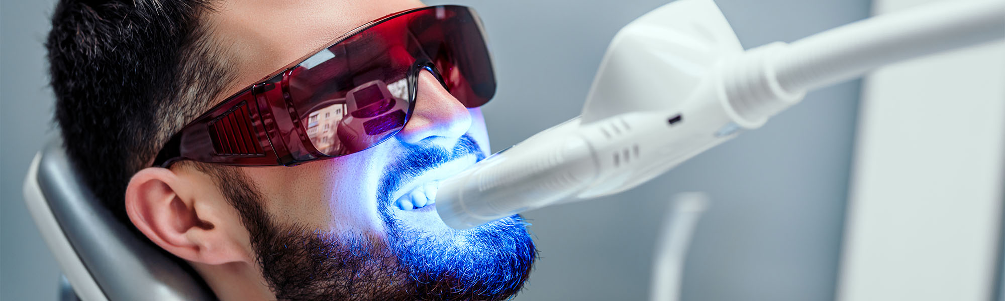 Fluoride Treatment Cerritos CA