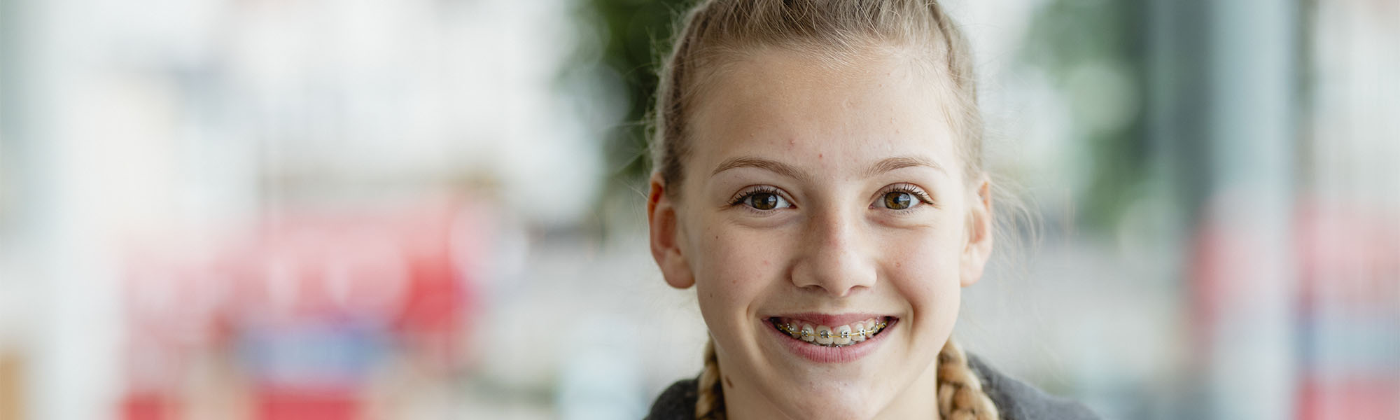 Metal Braces Cerritos CA