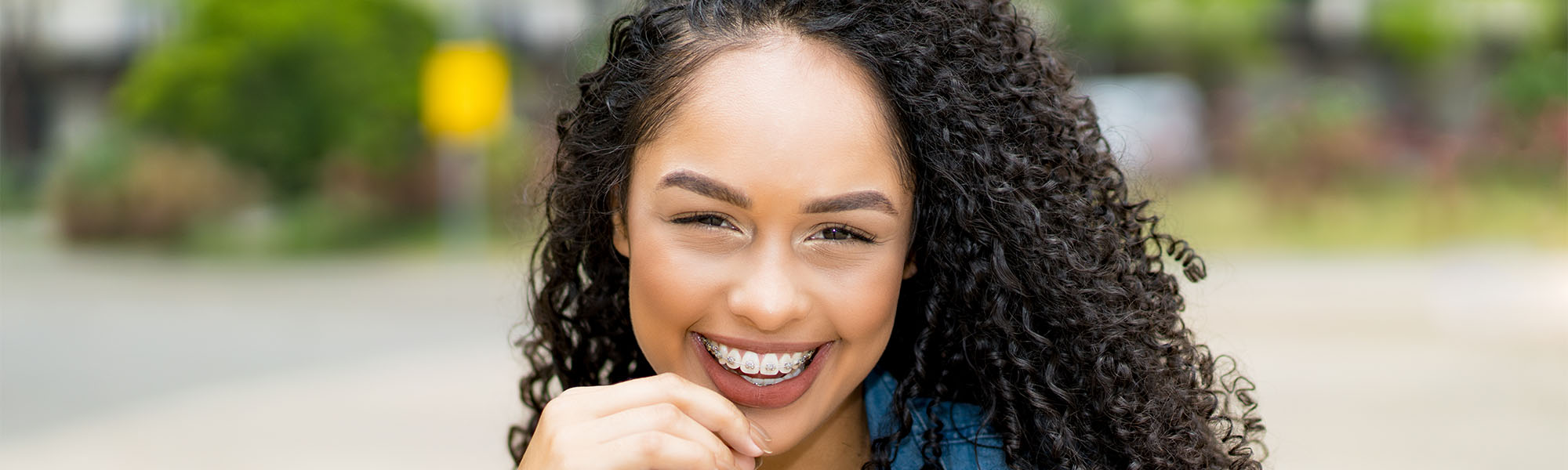 Orthodontics FAQs Cerritos CA