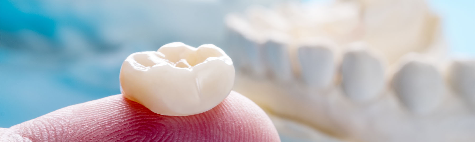 Porcelain Crowns Cerritos CA