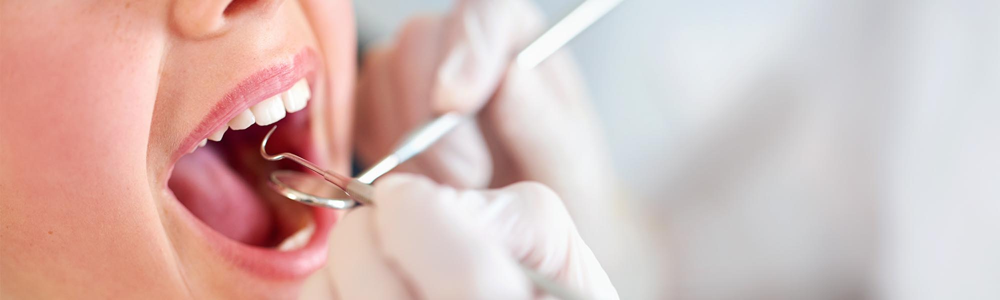 Air Abrasion in Cerritos CA