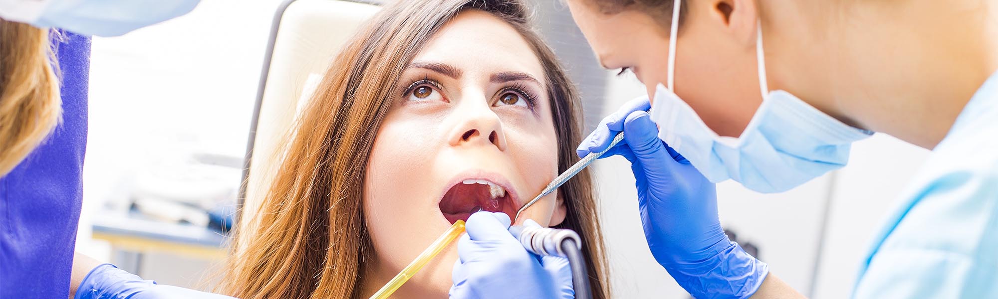 Dental Bonding In Cerritos CA