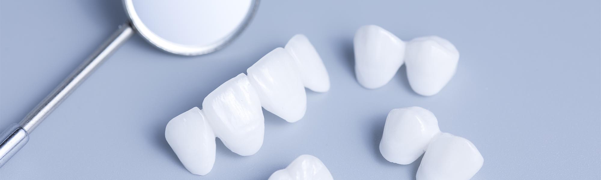 Dental Crowns Dentist in Cerritos CA