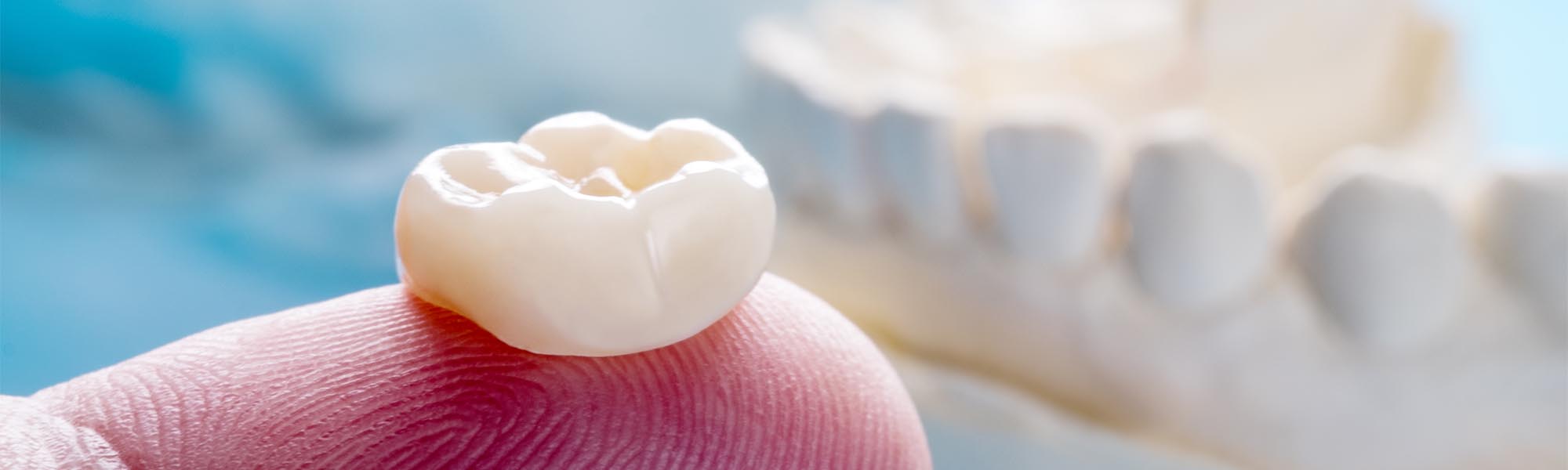 Dental Crowns Dentistry in Cerritos CA