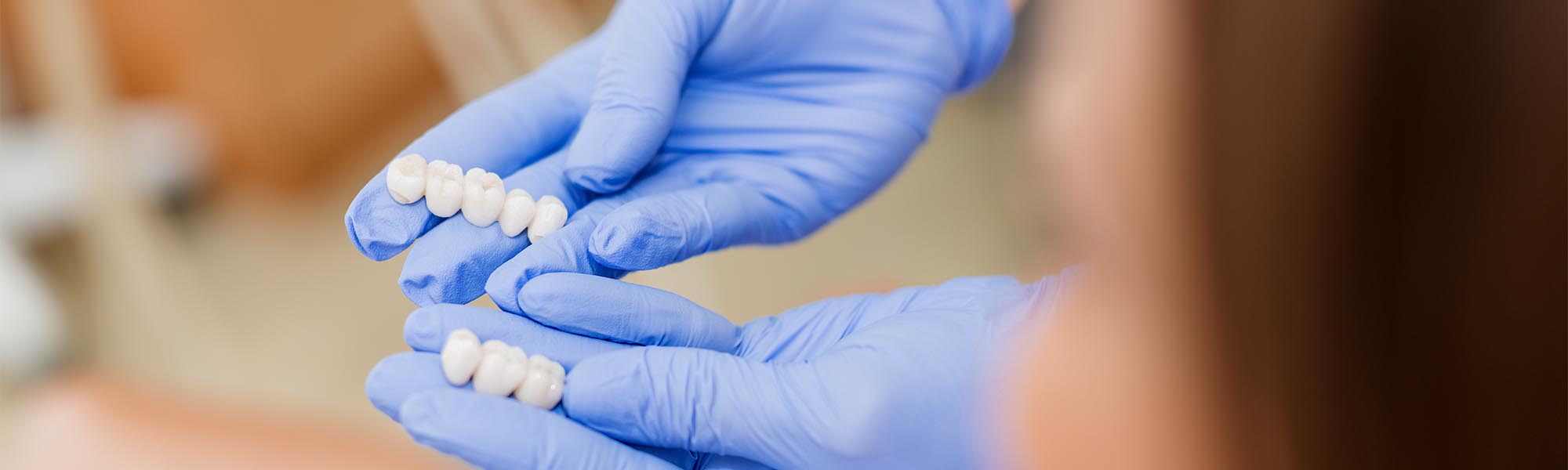 Porcelain Crowns Cerritos CA