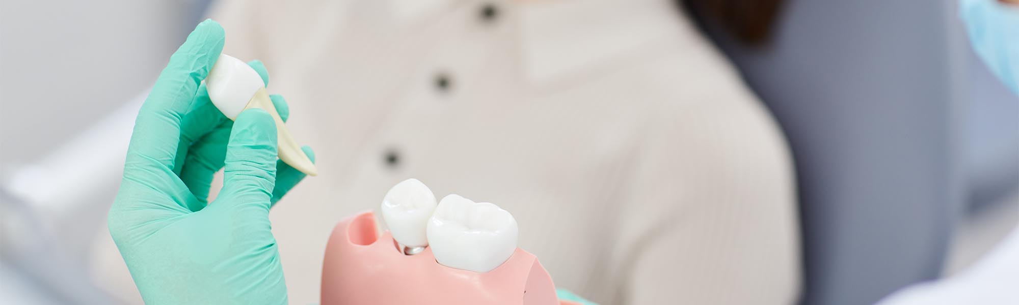 Tooth Extractions Cerritos CA