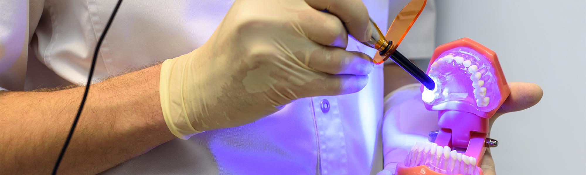 Porcelain Inlays & Onlays Dentist Cerritos CA