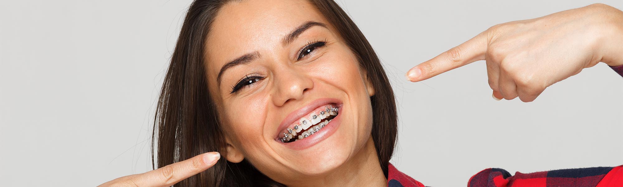 Metal Braces Cerritos CA