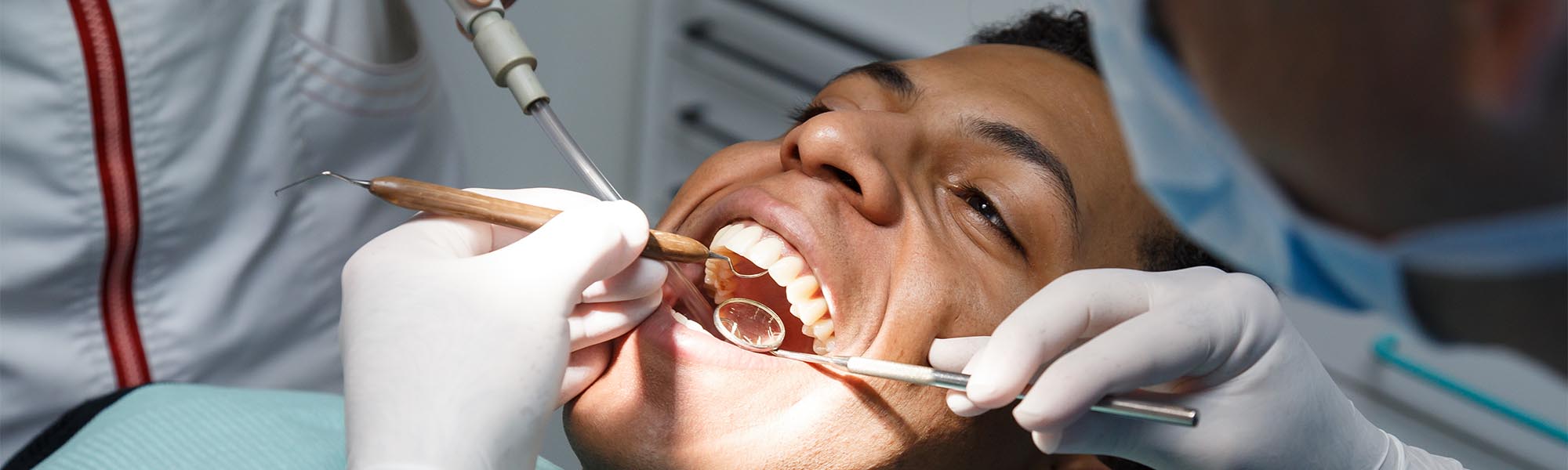 Root Canal in Cerritos CA