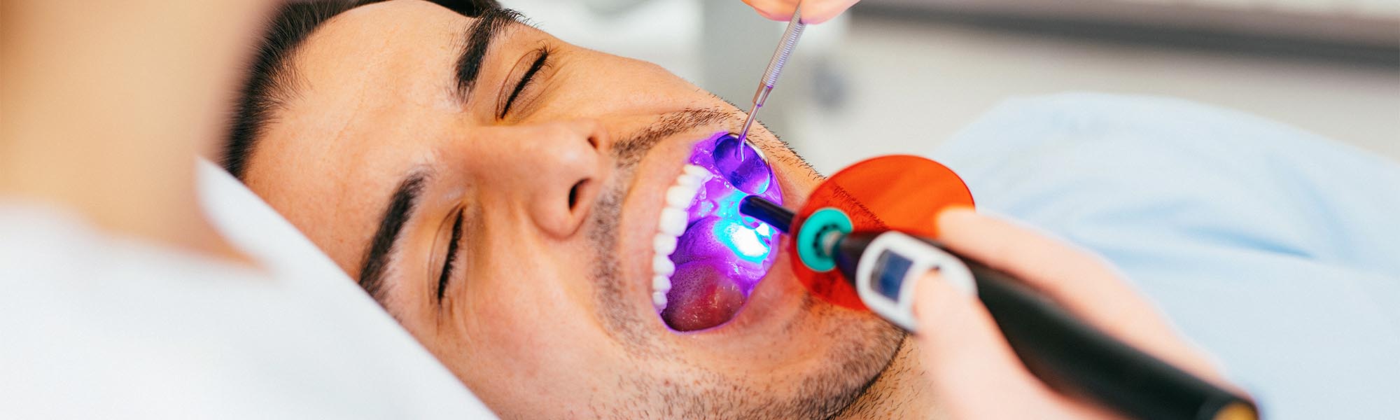 Dental Sealants in Cerritos CA