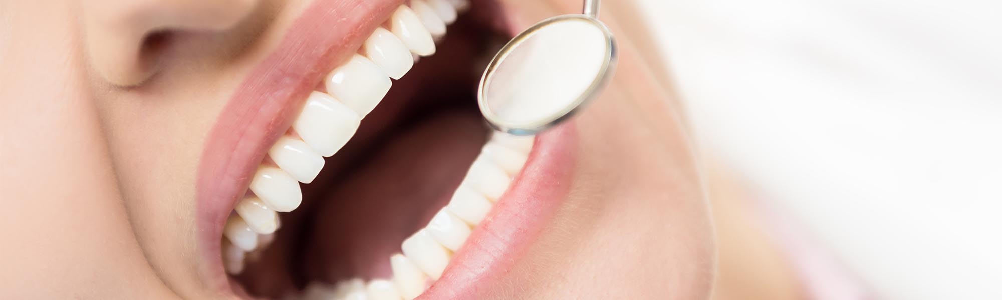 Soft Tissue Grafting Cerritos CA