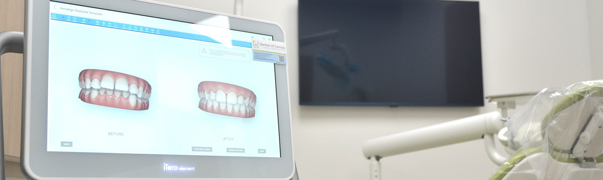Innovative Dental Technology Cerritos CA
