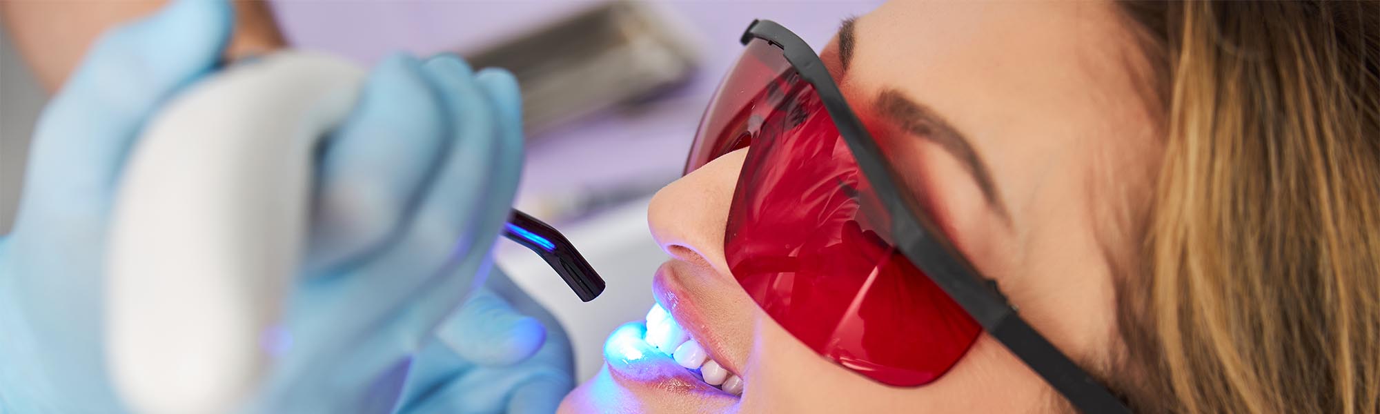Teeth Whitening in Cerritos CA