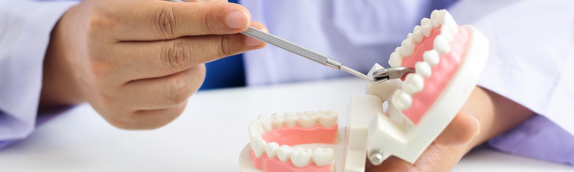 Wisdom Tooth Dentist Cerritos CA