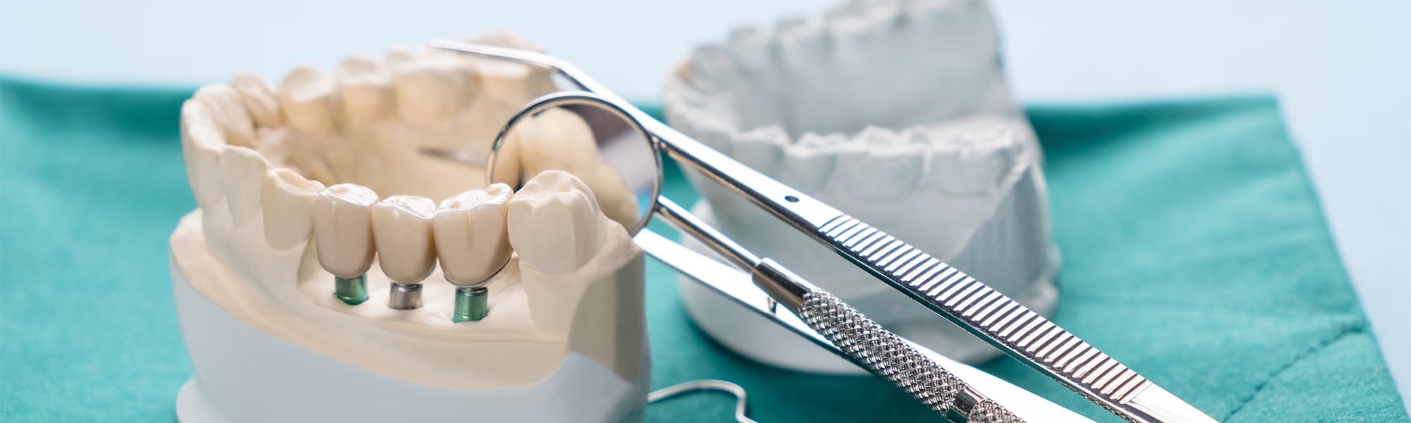 Wisdom Tooth Dentist Cerritos CA