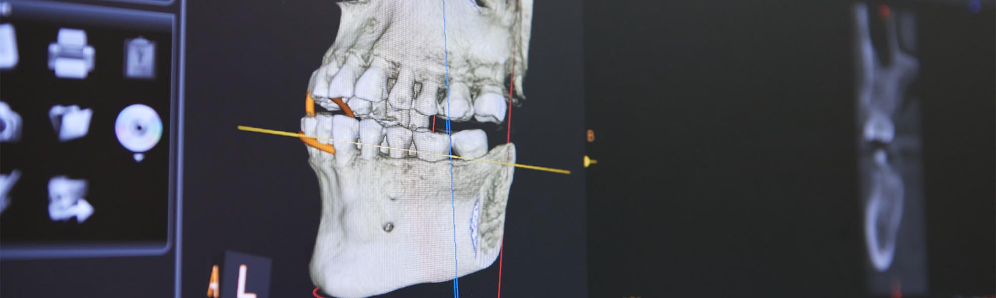 Digital X-rays Cerritos CA
